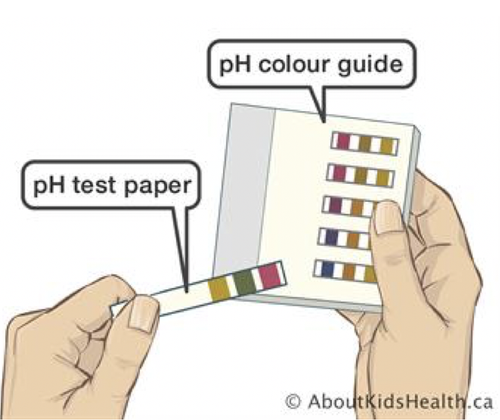 Alert What Is Best Practice For Confirming Placement Of Ng Tubes Connected Care Sickkids