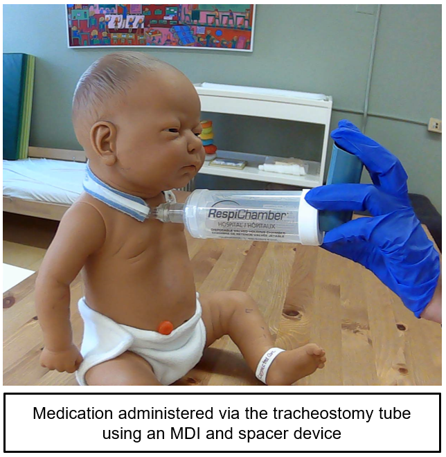 HINT How to administer medications to a child with a tracheostomy tube