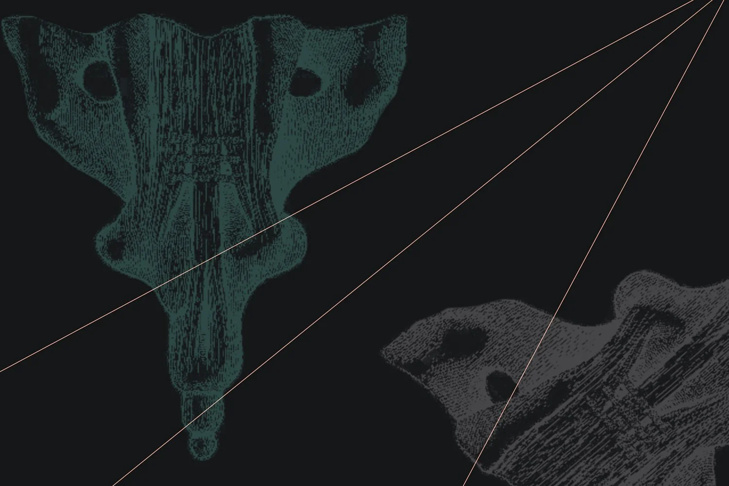 Sacroiliac Joint Dysfunction (3 Hours/3 NPCP CECs)