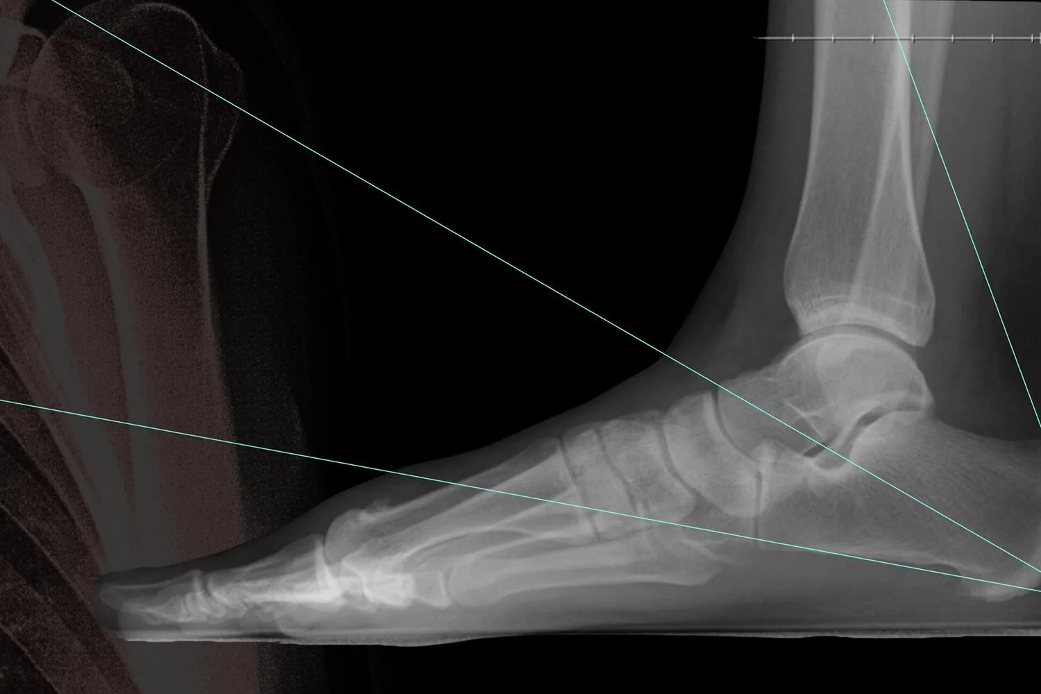 X-Ray Vision: Putting Your Anatomy Knowledge to Work! (3 Hours/3 NPCP CECs)