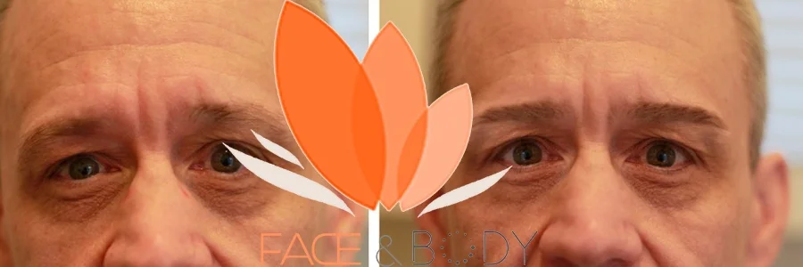 FACE AND BODY MAN MICROBLADING 5.png
