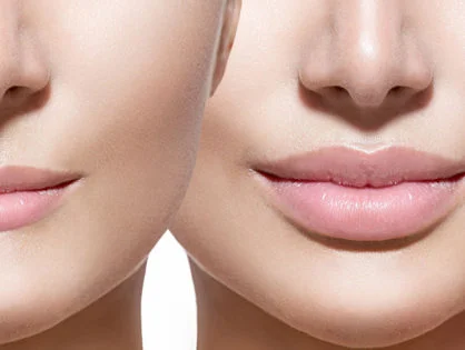 juvederm.jpg