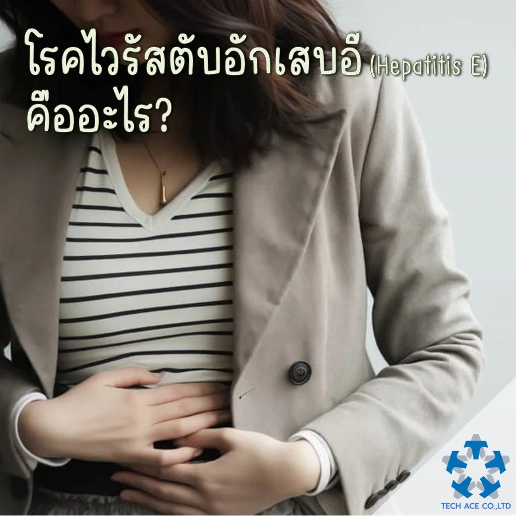 โรคไวรัสตับอักเสบอี (Hepatitis E) คืออะไร?