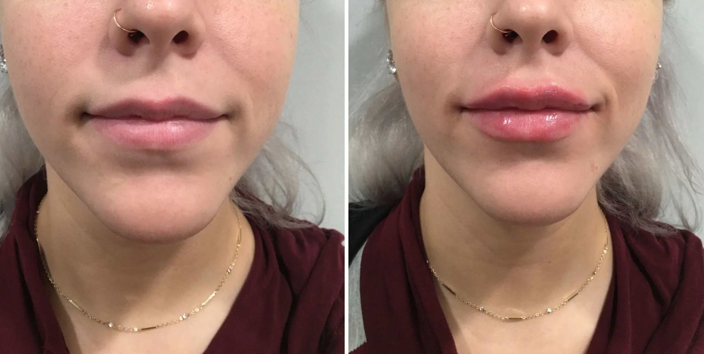 Lips