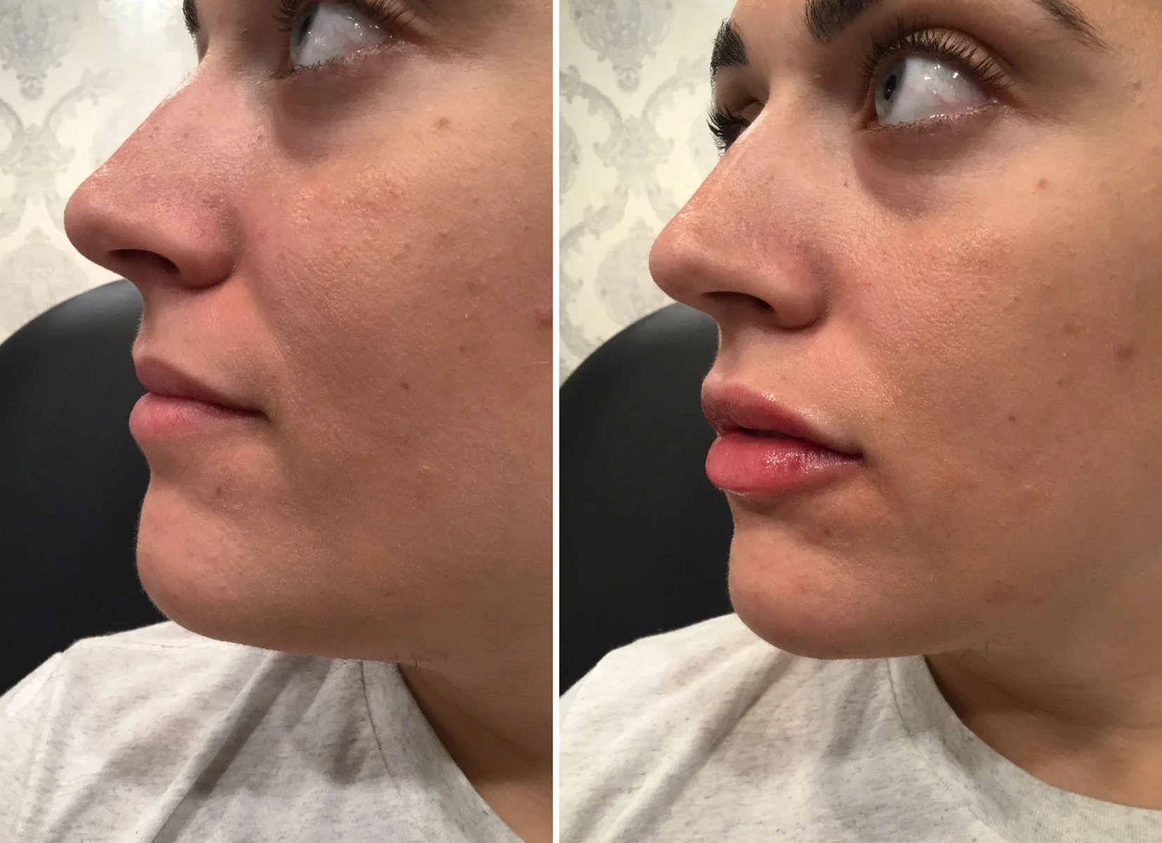 Lips