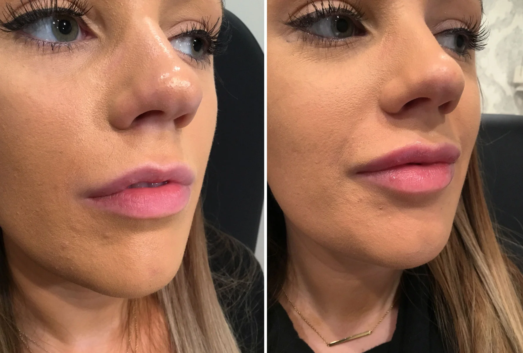 lips-11.jpg