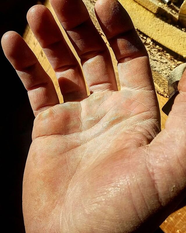 Who needs gloves.. when you have skin