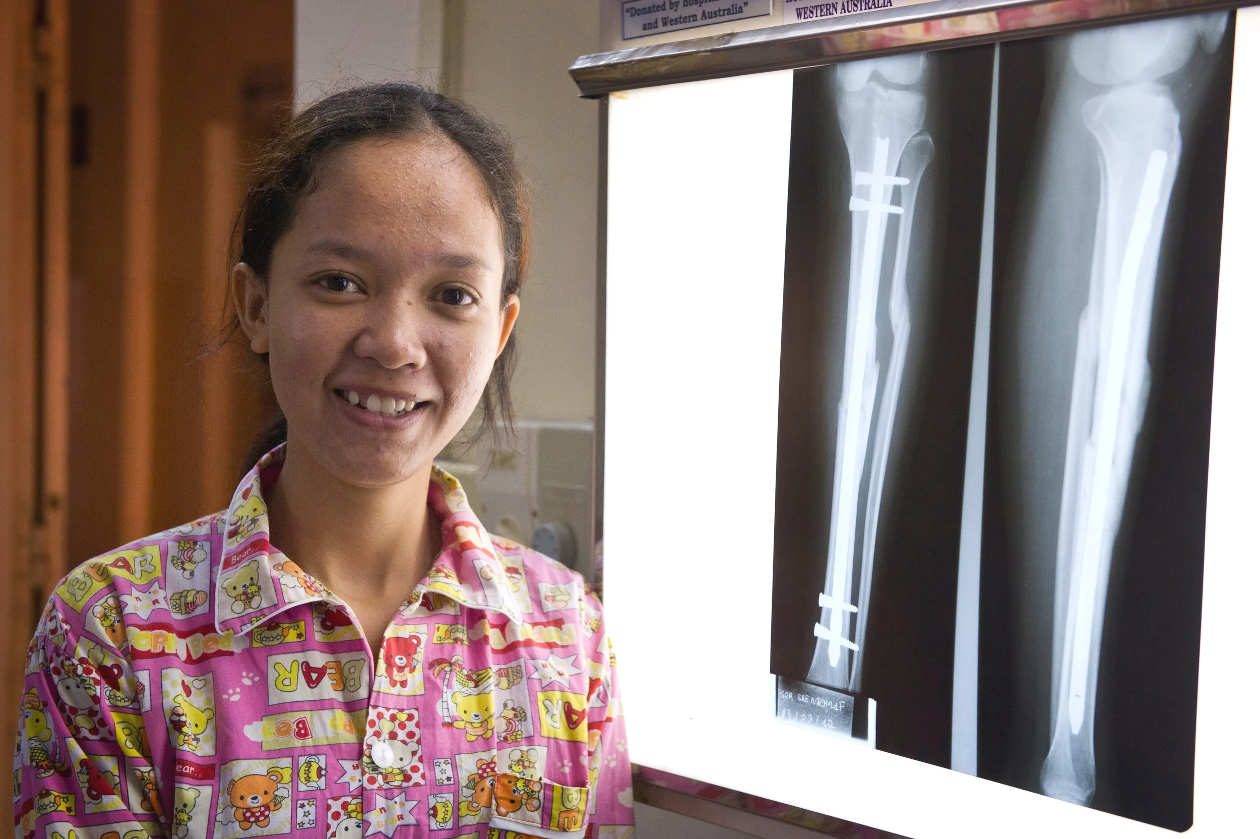 Sign Surgery Database For Surgeons — SIGN Fracture Care International