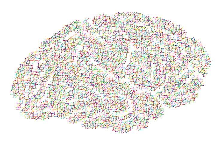 NEUROFEEDBACK :: Physical therapy for the brain