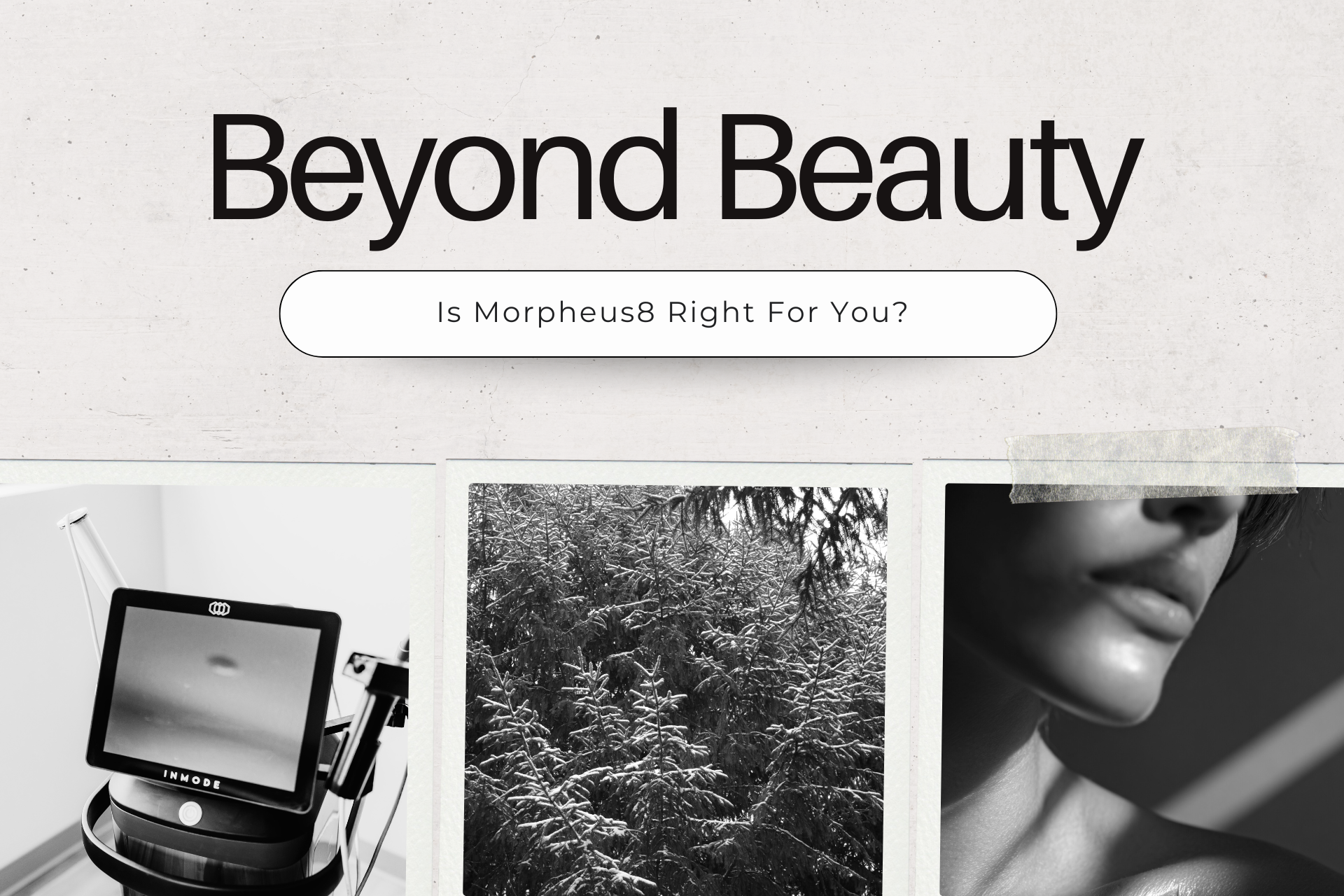 Is Morpheus 8 Right For Me?