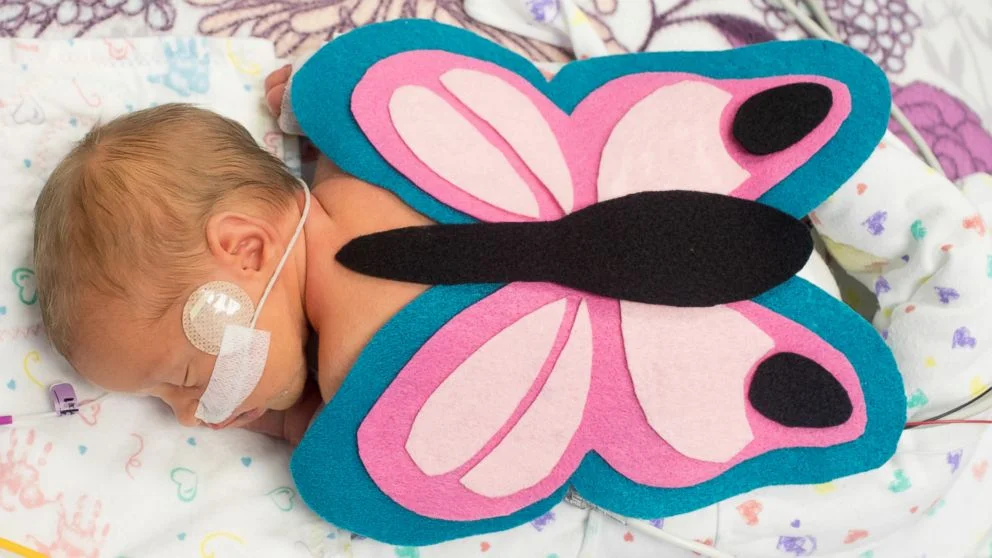 ABC News  | NICU Babies Get Special Tiny Halloween Costume