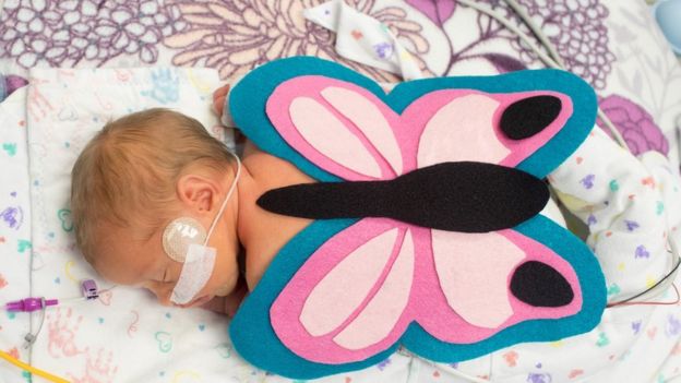 Eleanor and her twin sister Abigail were both dressed as butterflies. Image copyright: SCHAUMBURG PHOTOGRAPHY AND MARCH OF DIMES.