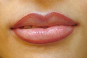 Lips-Edit.jpg