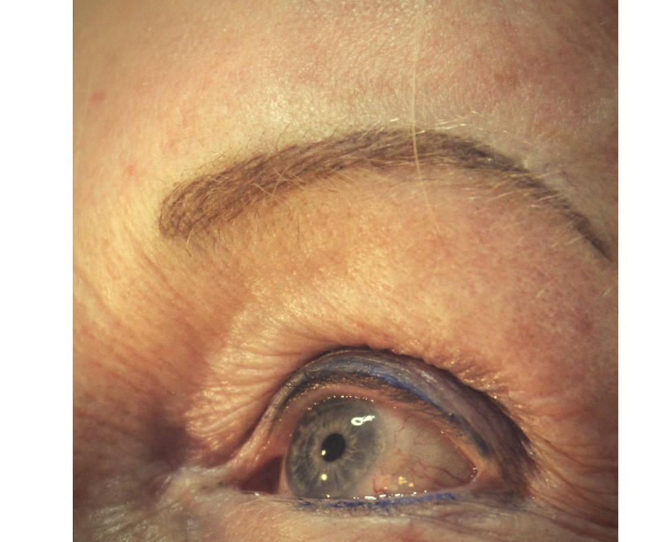 brow7.png