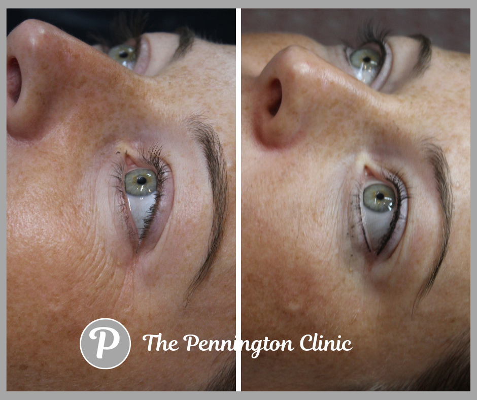 The Pennington Clinic (86).png