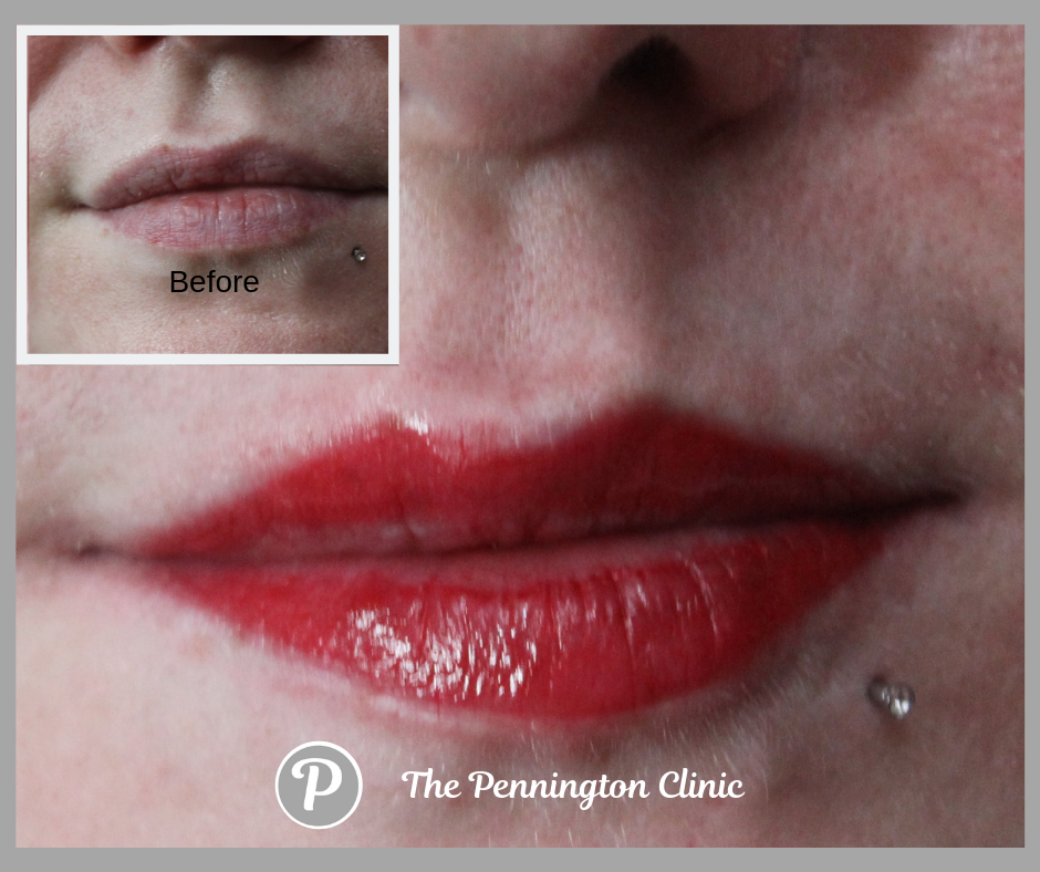 The Pennington Clinic (6).png