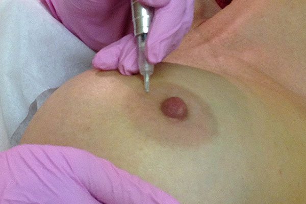 areola-tattoo-perth.jpg