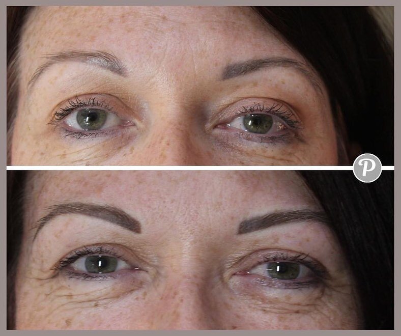 eyebrow colour boost procedure

We see most of our clients every 2 or 3 years for s colour boost procedure. The pigment used for semi permanent makeup is designed to fade gradually and gently in your skin.

It depends on your skin, what colour we wor