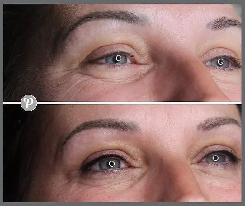 Having your eyeliner tattooed really makes your eyes stand out.

Look at these beautiful baby blues!

Imagine waking every day with this perfect eyeliner, going swimming, exercise.....! This eyeliner will stay put, smudge free for YEARS.

Eyeliner co