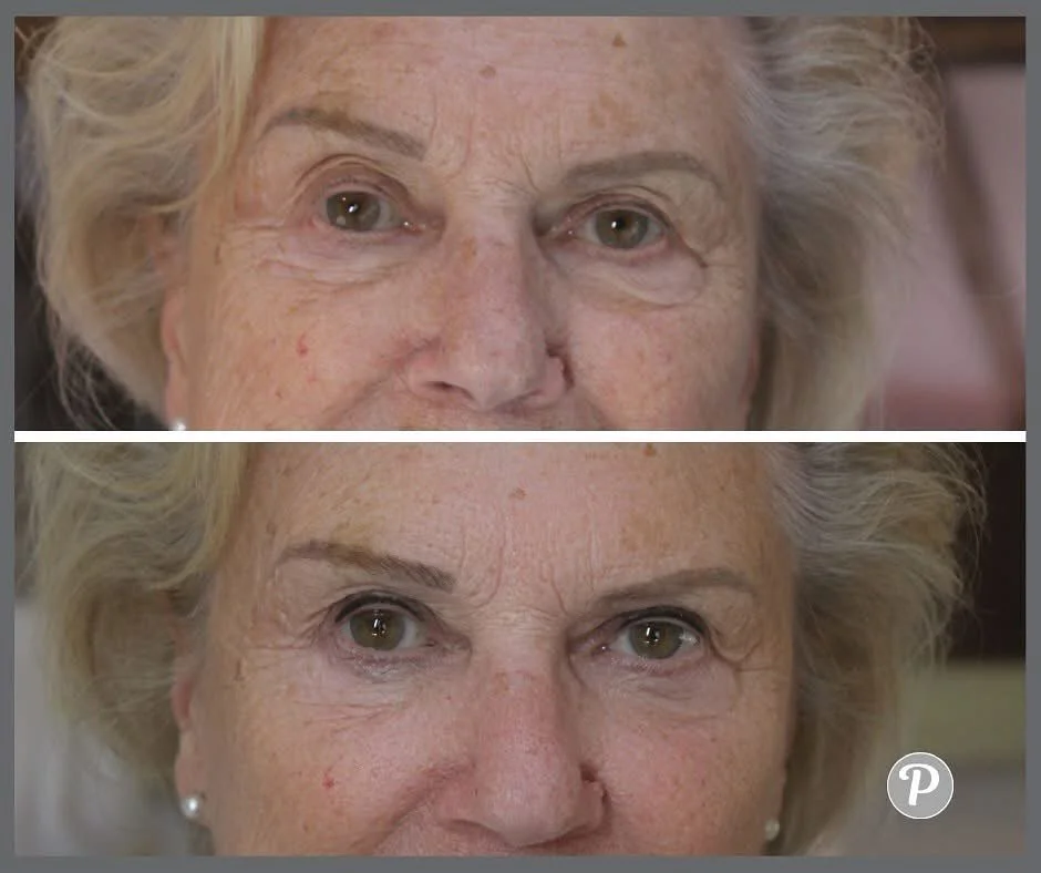 Permanent eyeliner gives you permanent definition around your eyes, which makes all of us look younger.

As teenagers many of us had lovely dark thick lashes giving us that definition naturally. The older we get the more our eyes seem to disappear in