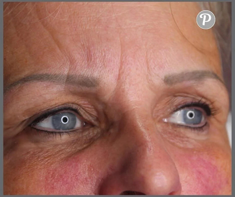 Top and bottom eyeliner to really make these beautiful blue eyes stand out.

This client is a runner (I don&rsquo;t mean she jumps off the bed and doesn&rsquo;t pay!) She runs almost daily and knowing that her eyeliner will stay put however sweaty sh