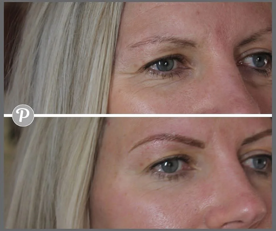 Many of our clients have delayed having their brows tattooed because they are worried about having heavy sluggy dark brows.

We hear you!

Emma is so clever at working with just the right colour pigment to sit looking very natural in your skin. She b