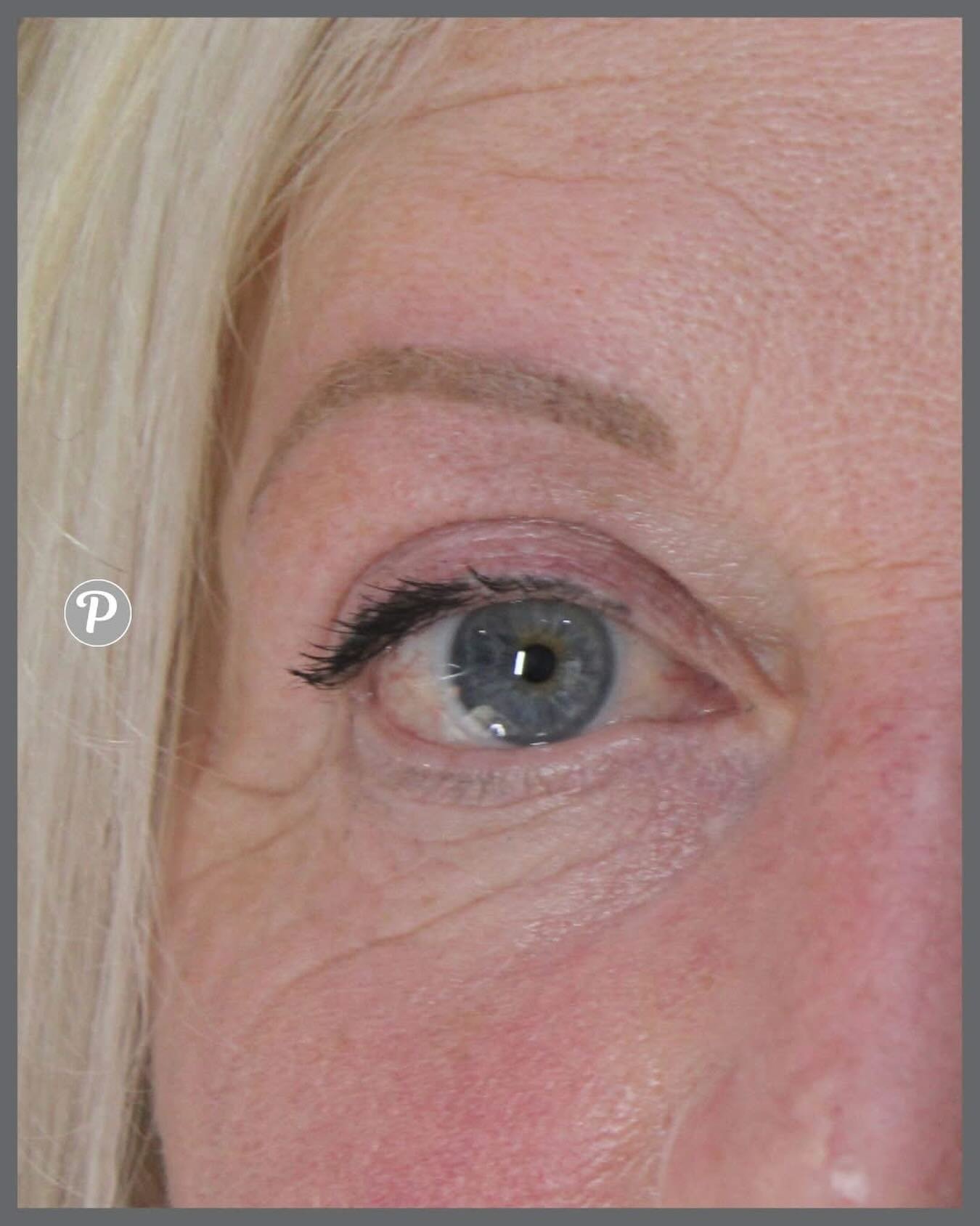 Many (most) of our clients are looking for a very soft brow. 

No harsh lines, no outlines, nothing that looks &ldquo;obvious&rdquo;, just a soft gentle smattering of pigment in the agreed brow shape, sitting behind your natural brow hair.

www.thepe