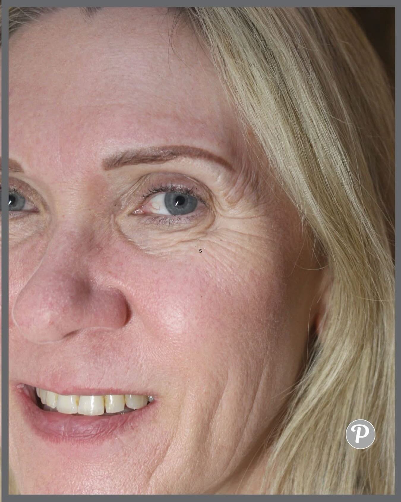 🌸 &ldquo;Nervous about semi-permanent makeup? Don&rsquo;t be. We work gently, listen carefully, and make sure you feel comfortable every step of the way. Hundreds of women over 50 have trusted us&mdash;and left smiling.&rdquo; 
💬 Message us to chat