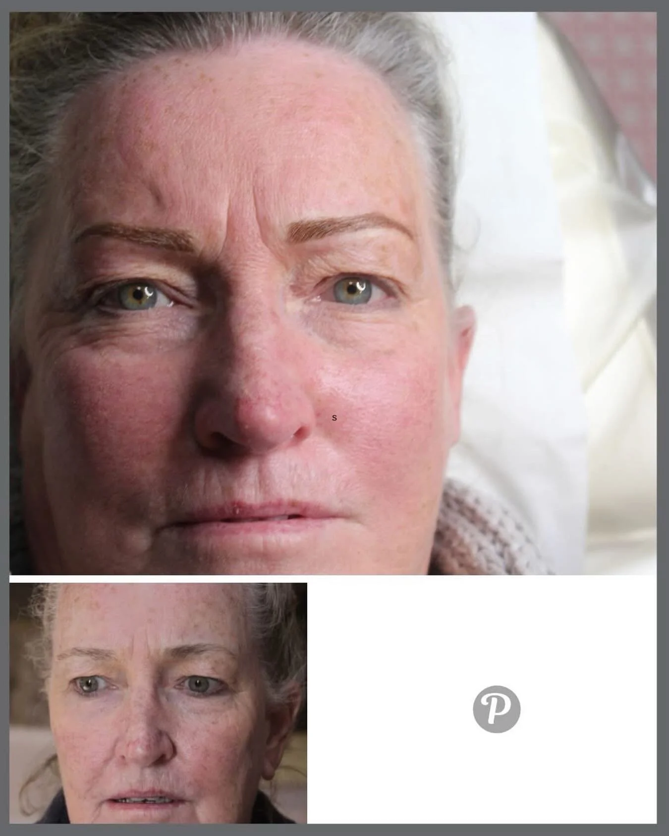 A soft powdering of colour, implanted in the perfect shape adds depth and defnintion to these brows.

You can see from the before picture that this client is lucky enough to still have brow hair, but the shape needed improving.

This powder brow give