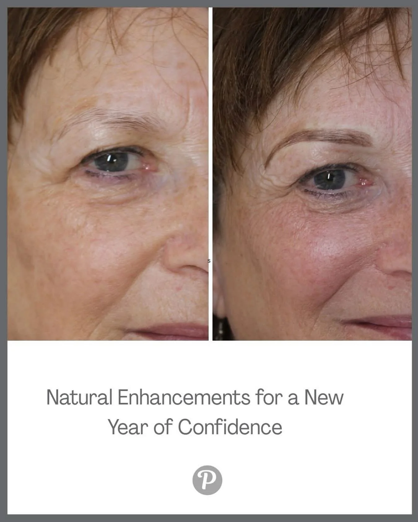 Our treatments aren&rsquo;t about changing your face.

They&rsquo;re about giving back what time has gently taken &mdash; shape, colour, definition, and that spark of confidence when you catch your reflection. 

2026 is the perfect moment to rediscov