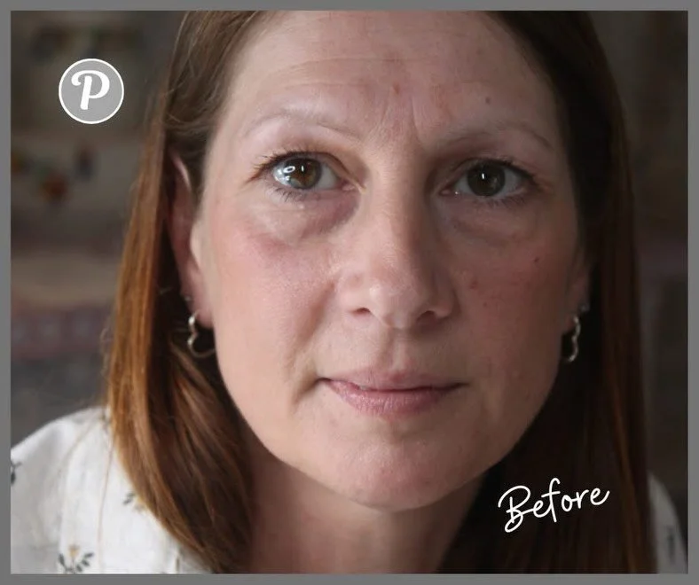 Confidence starts with Definition!

Brows fading? Eyeliner smudging? Lip line disappearing? These are the most common reasons clients visit us &mdash; and the transformation is always beautifully subtle.

At our private garden clinic in Forest Row, E