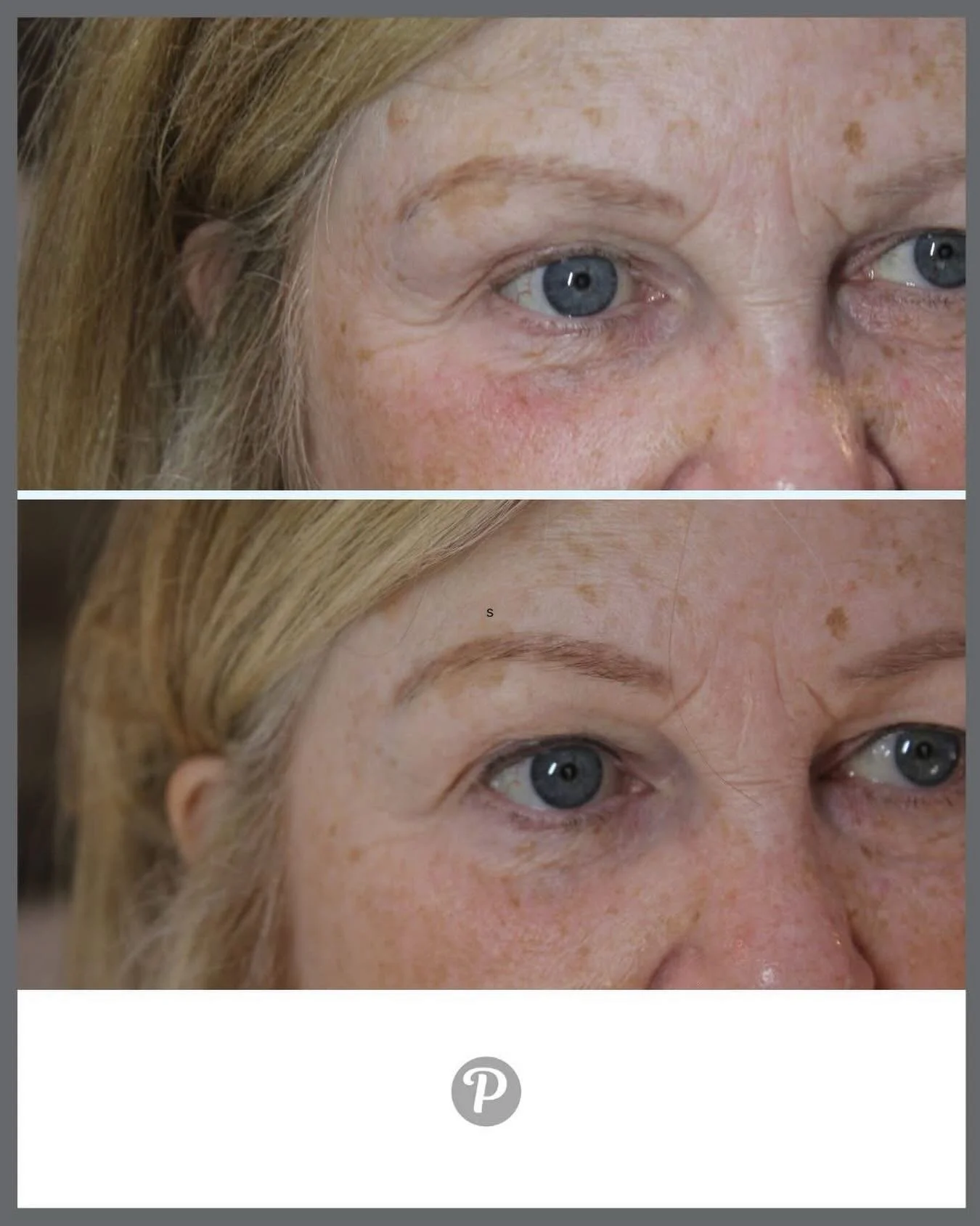 ✨ The most natural kind of transformation ✨
A soft Powder Brow tattoo paired with subtle Permanent Eyeliner at The Pennington Clinic can completely elevate your features &mdash; yet still look like you. That&rsquo;s the beauty of these treatments: th