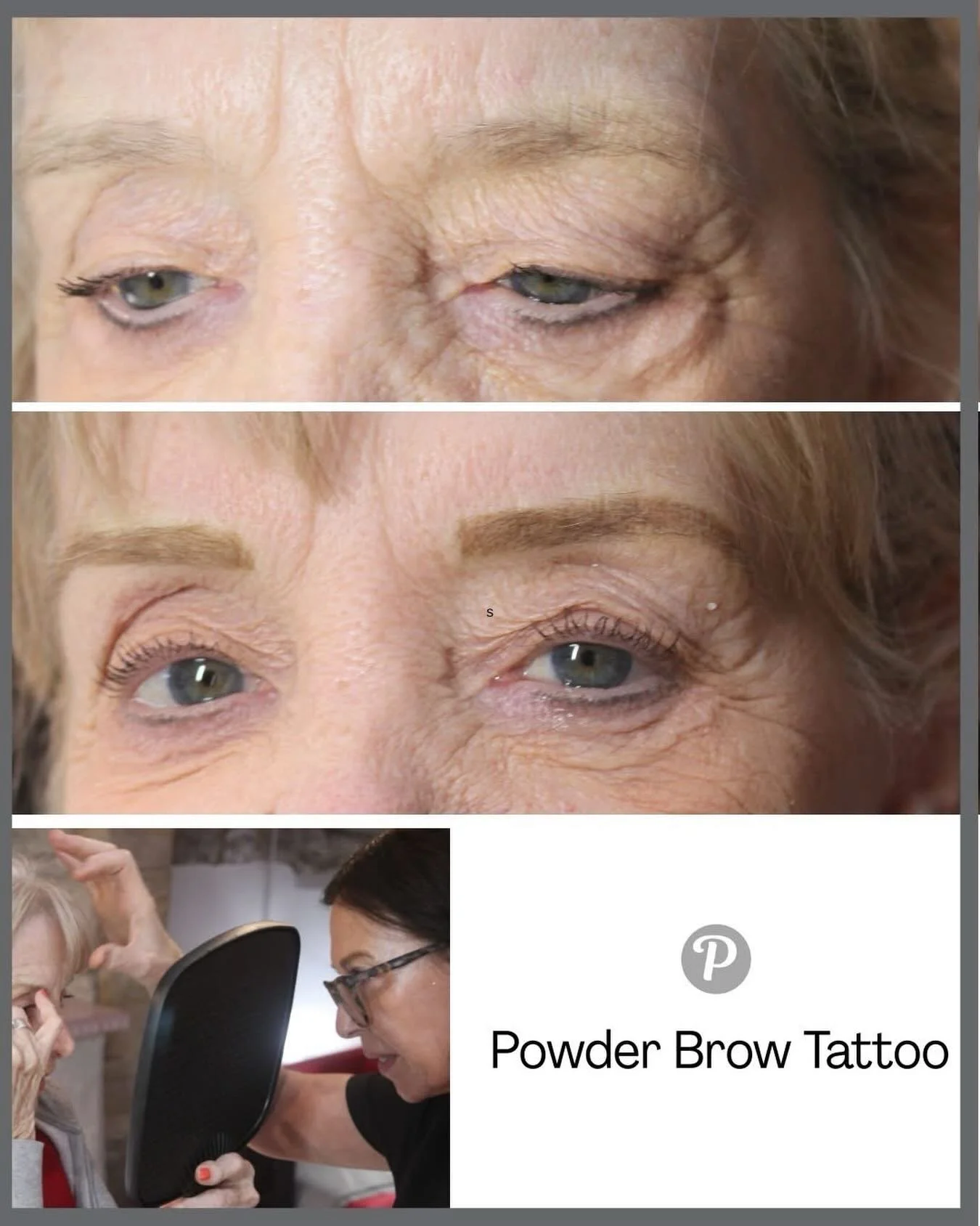 Powder Brows at The Pennington Clinic are a game‑changer for mature skin. This gentle tattooing technique creates a soft, shaded finish that mimics the look of perfectly pencilled‑in brows &mdash; without the daily effort.
🌿 Why older skin loves Pow