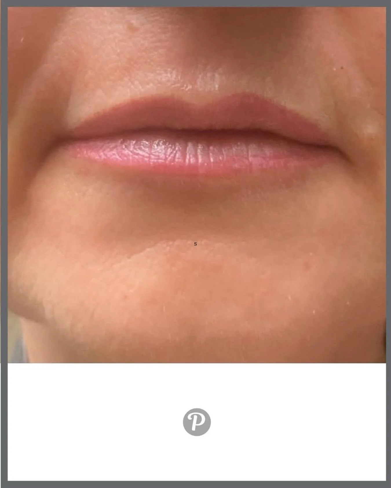 💋 Natural, defined, effortlessly polished &mdash; every single day
A Lip Tattoo treatment at The Pennington Clinic is all about subtle enhancement, not dramatic change. When the shape of your lips is gently redefined and a soft wash of permanent col