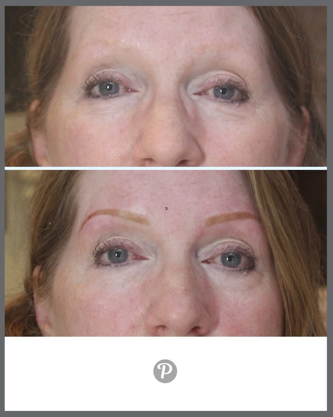 From No Brows to WOW Brows &mdash; Without the Slugs!

So many of our lovely clients arrive at The Pennington Clinic feeling nervous about one thing:

&ldquo;I don&rsquo;t want big, heavy, sluggy brows!&rdquo;

And honestly&hellip; we get it.
If you&