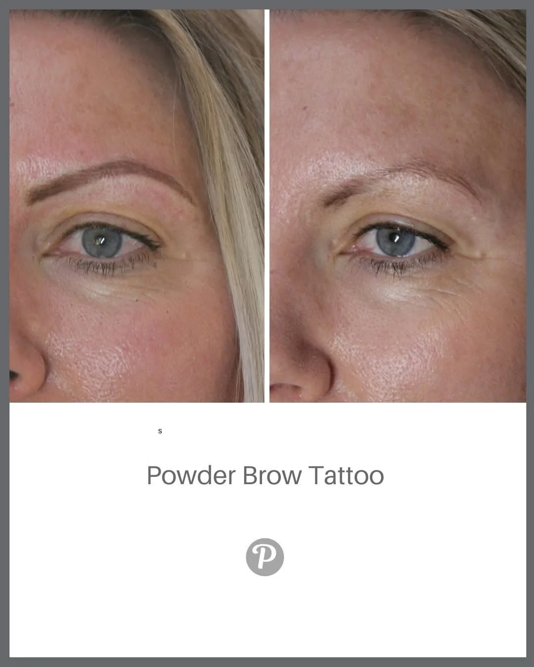 Powder brow tattoos at The Pennington Clinic can be soft or bold.

Your brows, your way &mdash; that&rsquo;s our promise.

At The Pennington Clinic, we know that no two clients are the same. Some of you dream of a soft, barely‑there brow that looks e