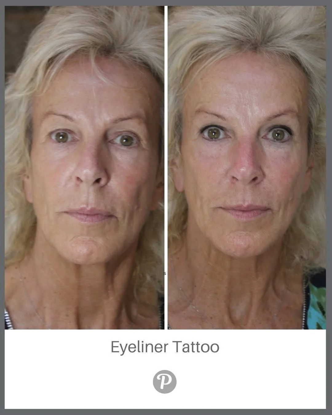 Perfect eyeliner? Can you imagine? 

No more smudges.
No more panda eyes.
No more rushing to fix your makeup halfway through the day.

Come and see us for an eyeliner tattoo at The Pennington Clinic, your liner stays flawless from morning to night - 