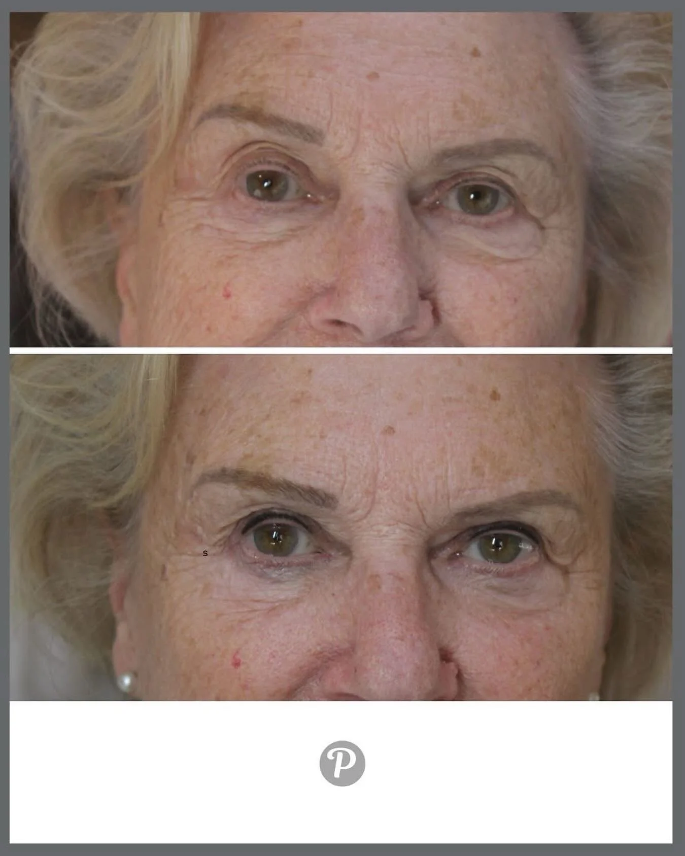 Ever notice how a little eye definition can take years off your look? 

Permanent eyeliner does exactly that&mdash;no smudging, no effort, just naturally youthful eyes from the moment you wake up. 

Our clients at The Pennington Clinic love how it op