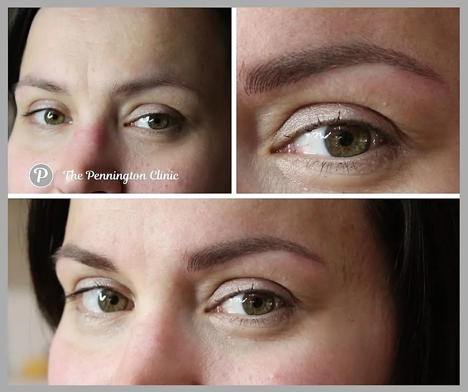 Let&rsquo;s talk brow truth: Hairstrokes aren&rsquo;t a &ldquo;one size fits all&rdquo; deal.
We all love that crisp, &ldquo;born with them&rdquo; look, but the reality is that skin type and age play a huge role in your final result. For some, hairst