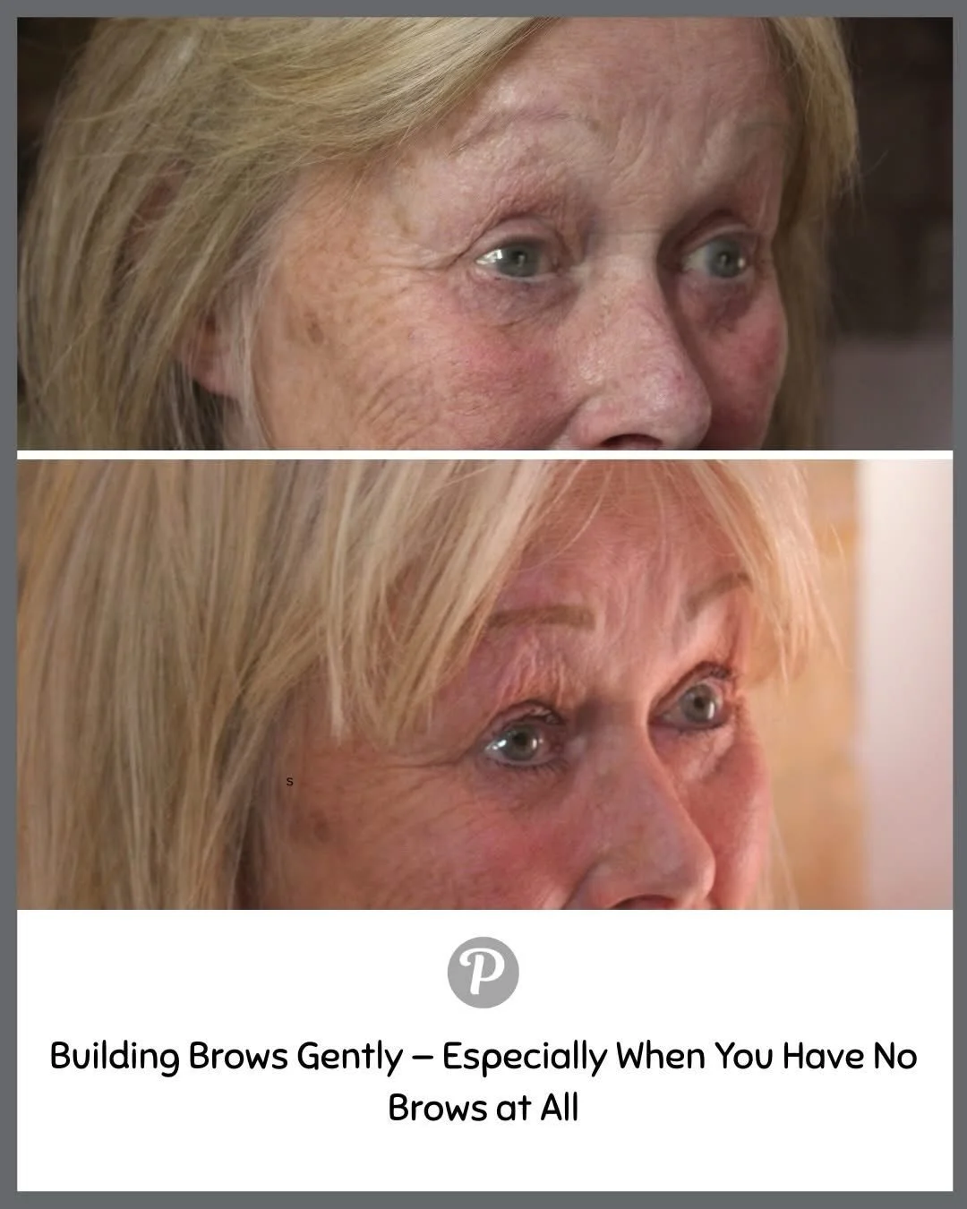 So many of our lovely clients come to us with very fair, grey, or almost no brows at all and we completely understand why the idea of suddenly having brows can feel like a big leap.

That&rsquo;s why at The Pennington Clinic, we never rush the proces