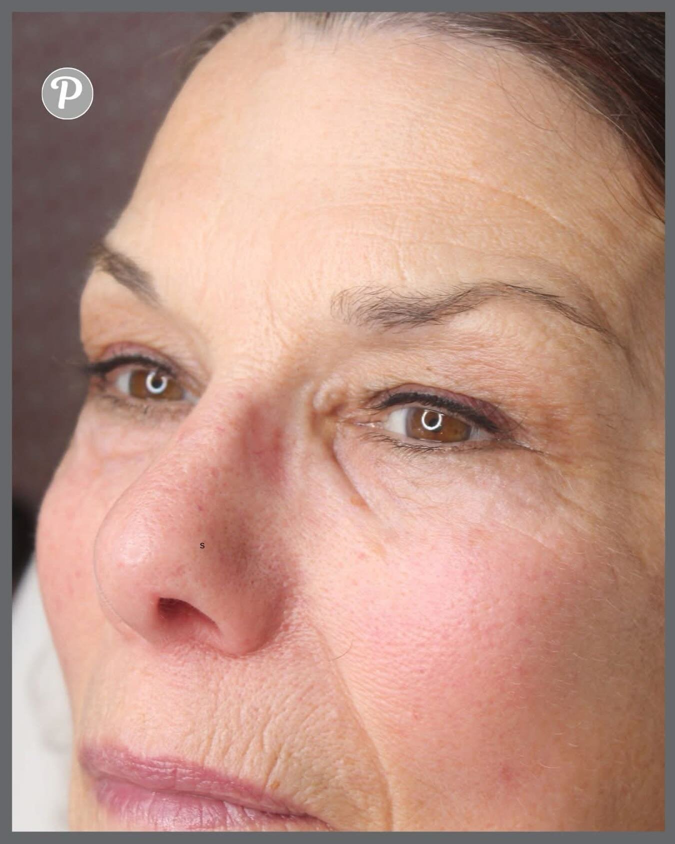 Permanent eyeliner is a total game changer.

As we get older, we naturally lose definition around our eyes &mdash; lashes lighten, lids soften, and suddenly that daily eyeliner becomes a chore. 
Many of our clients come to us saying they&rsquo;re fed