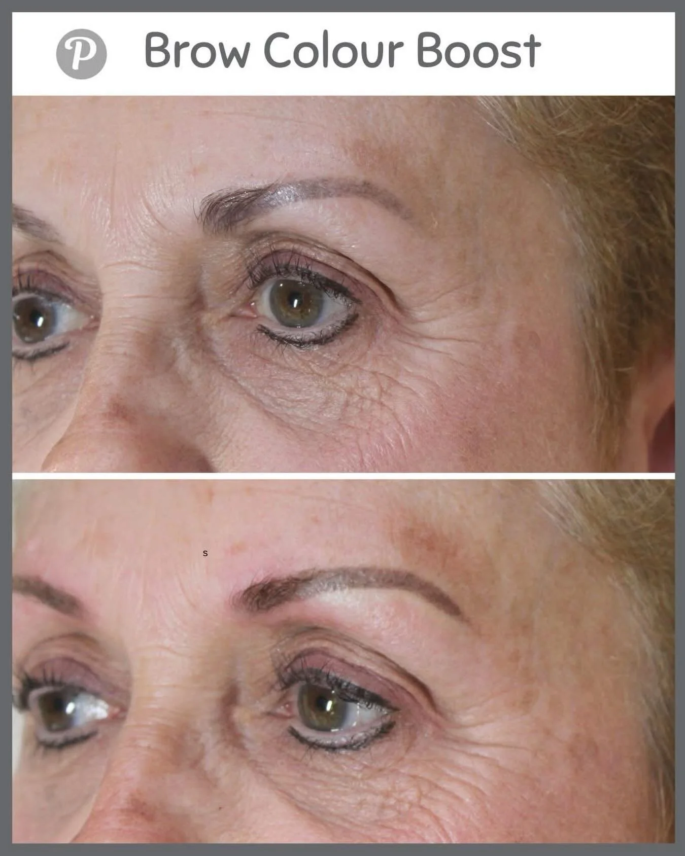 We love seeing our clients every few years!

Once you become a brow client at The Pennington Clinic, you&rsquo;re part of our long‑term brow family. Most of our ladies pop back to see us every couple of years for a Brow Colour Boost (&pound;175) , a 