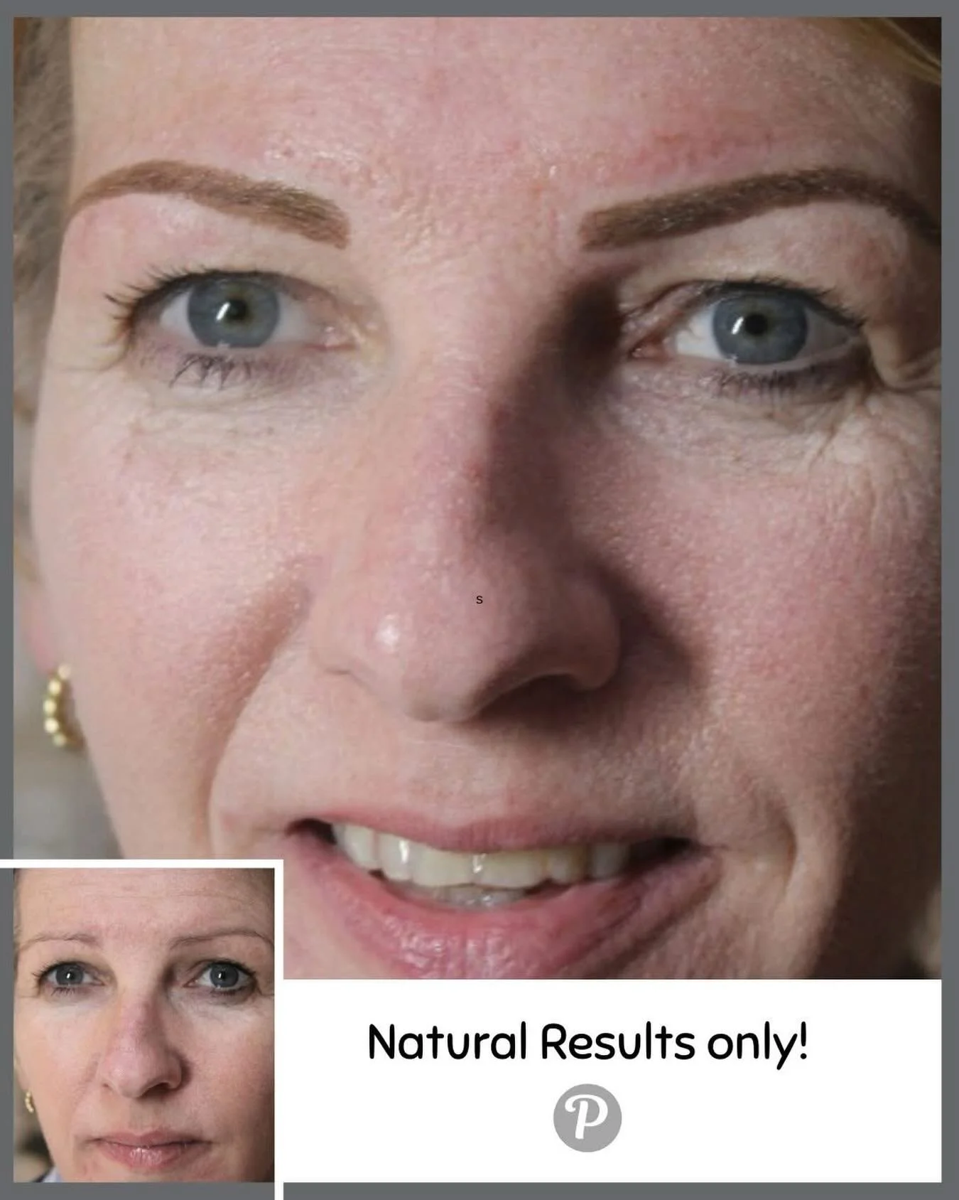 ✨ Soft. Natural. Undeniably You. ✨
At The Pennington Clinic, our signature soft powder brow treatment is all about enhancing what you already have - gently, subtly, beautifully.

No harsh lines. No heavy blocks. Just a whisper of colour placed behind