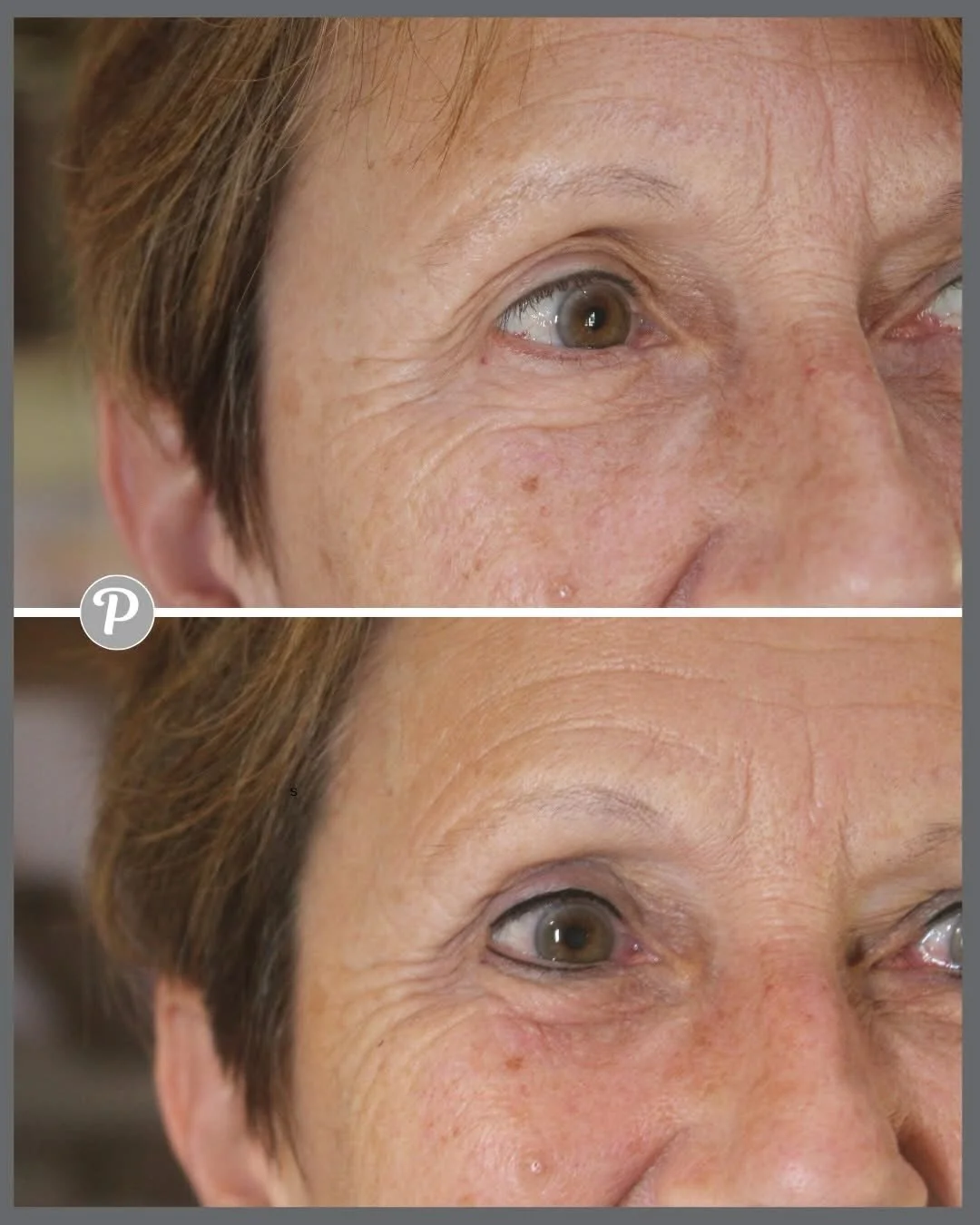 ✨ Before &amp; After: The Power of Defined Eyes ✨

When your eyes are beautifully framed, everything lifts your expression, your confidence, your whole face. A soft, expertly placed eyeliner can make your lashes look fuller, your eyes brighter, and y