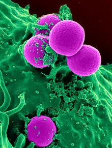 Human_neutrophil_ingesting_MRSA.jpg