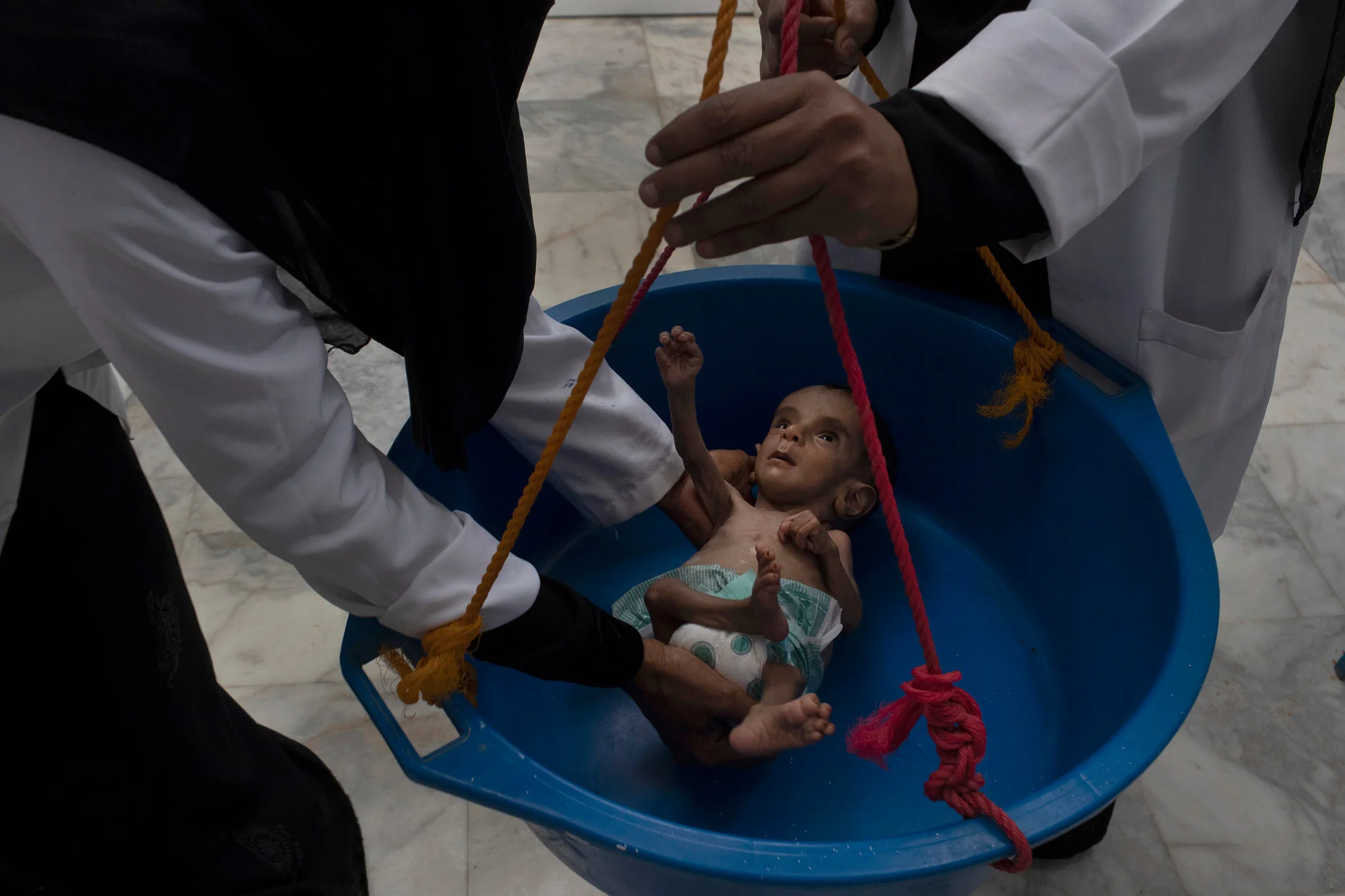 For Starving Children, a Bite of Hope