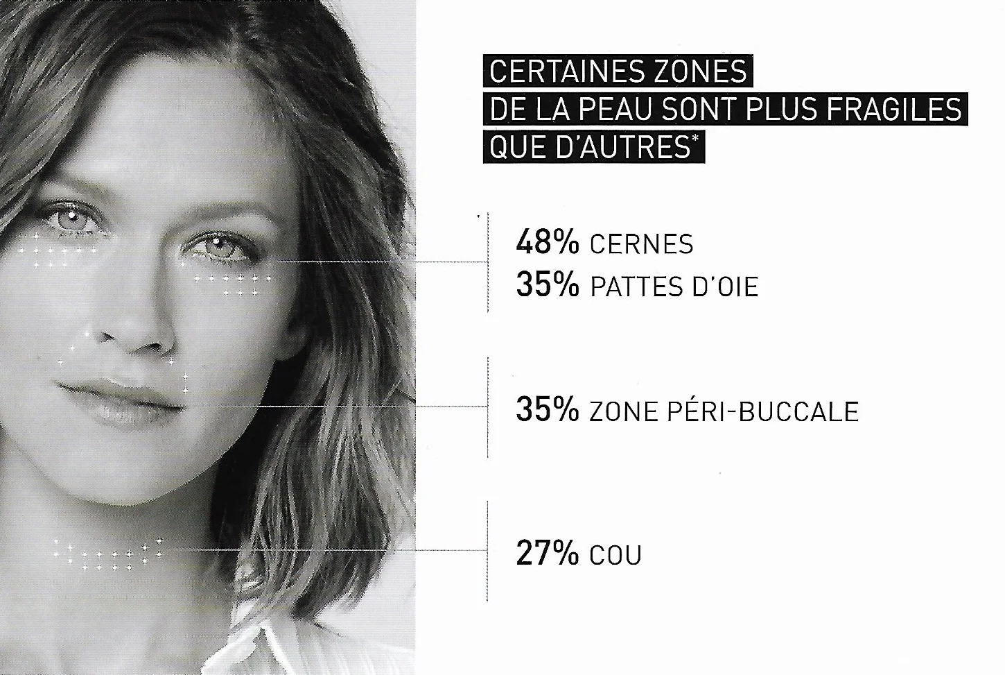 Nanosoft® - Un nouveau dispositif exclusif pour zones sensibles