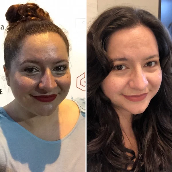 So this is life after Gastric Sleeve surgery Part 1