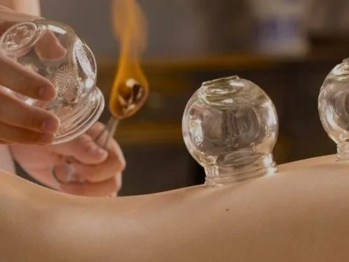 cupping+%281%29.jpg