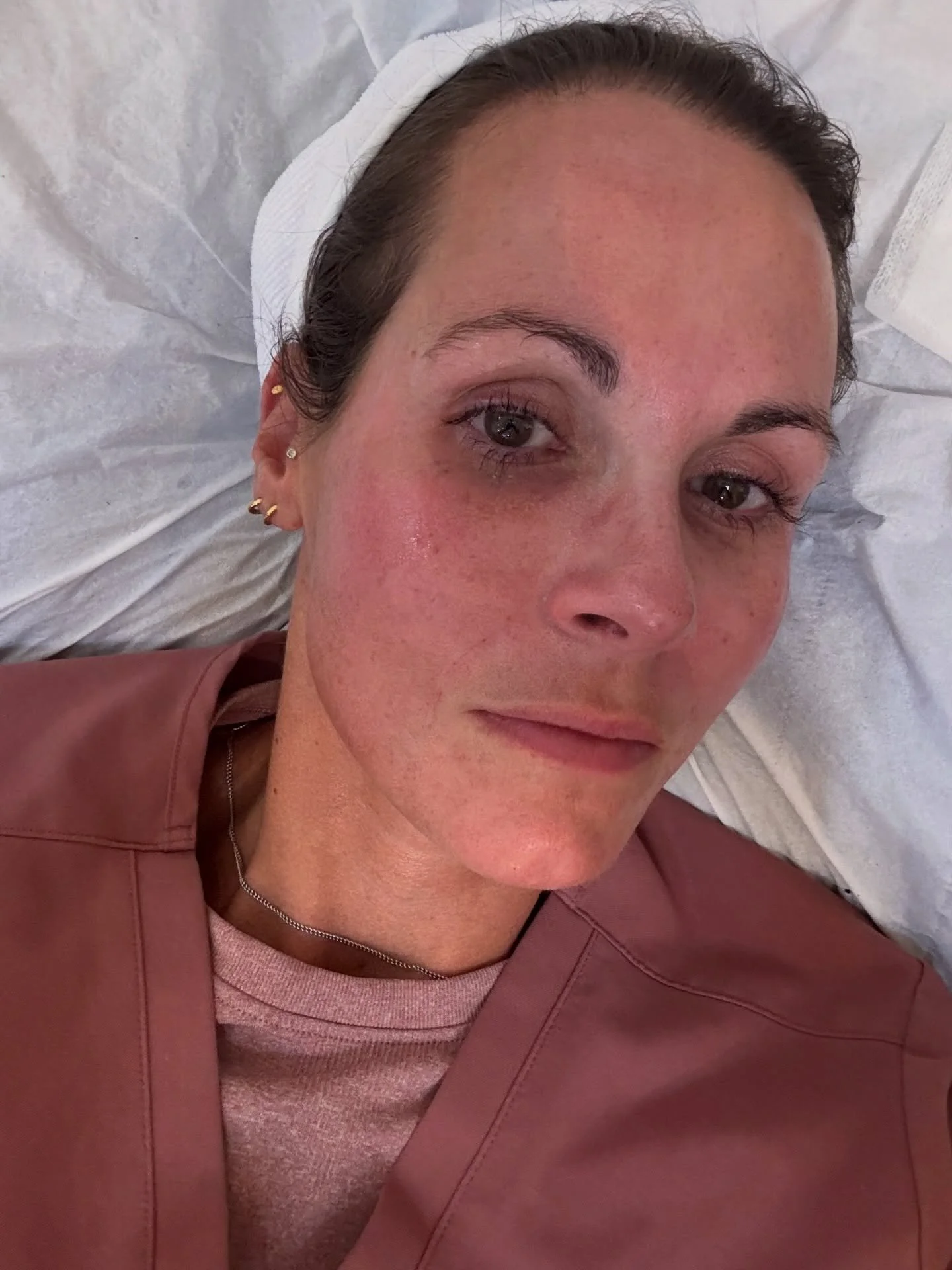 November has been a month of &hellip;.

Upgrading my microneedling pen and training 
Preparing for the busy season with my favourite 
Bonfire night 
Annual weekend away with my Best ones
Amazing food from Chef Ryan 
Training in RADIESSE and introduci